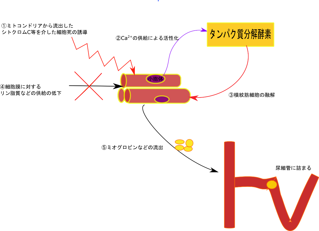 横 紋 筋 融解 症